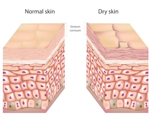 Normal Skin and Dry Skin - The Wellnest by HUM Nutrition