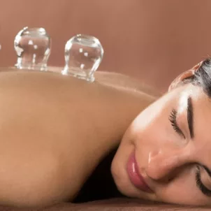 Woman laying down on her stomach with eyes closed, receiving a cupping treatment