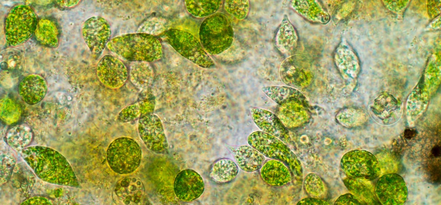 3 Chlorella Benefits to Support Healthy Detoxification HUM Nutrition Blog