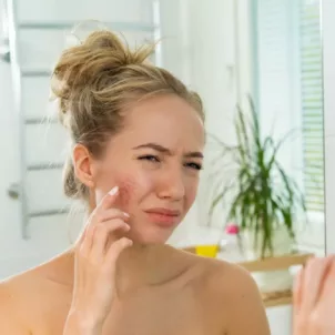 Woman looking in bathroom mirror upset about her cystic acne