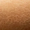 Close-up of dry skin that would benefit from a GLA fatty acid supplement