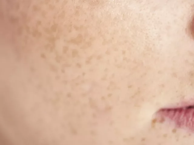 Close up of bare skin during skin fasting test