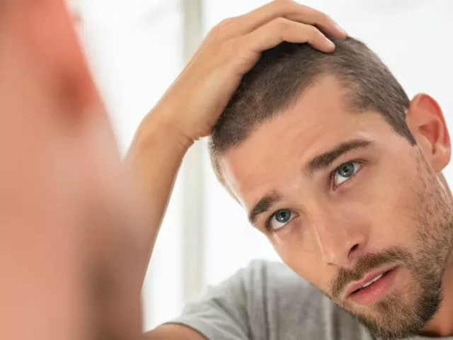 Young man touching hair in mirror concerned about men's hair loss and what causes it