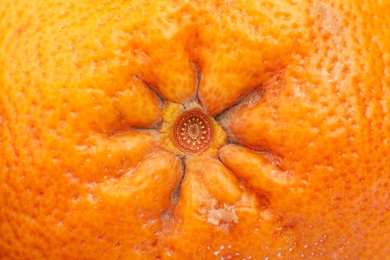 Hemorrhoid concept on the pit of an orange