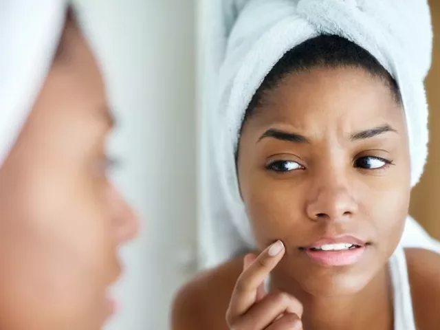 Woman freshly out of shower looking at her skin in mirror, trying to discover if she has blind pimples and how to treat them