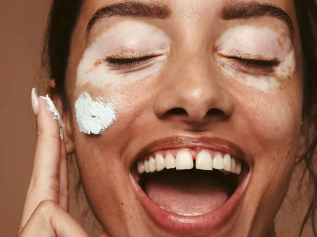 dehydrated skin vs dry skin woman applying cream