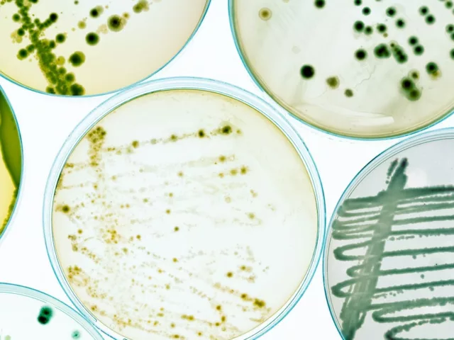 bacteria in petri dish