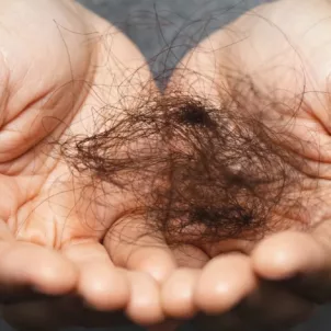 How much hair loss is normal