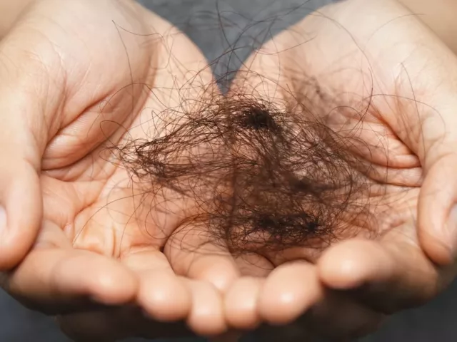 How much hair loss is normal