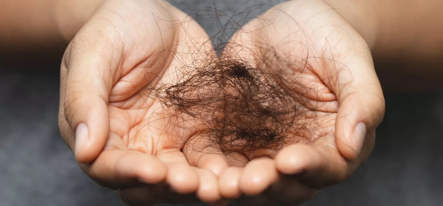 How Much Hair Loss is Normal? A Trichologist and Derm Explain.| HUM  Nutrition Blog