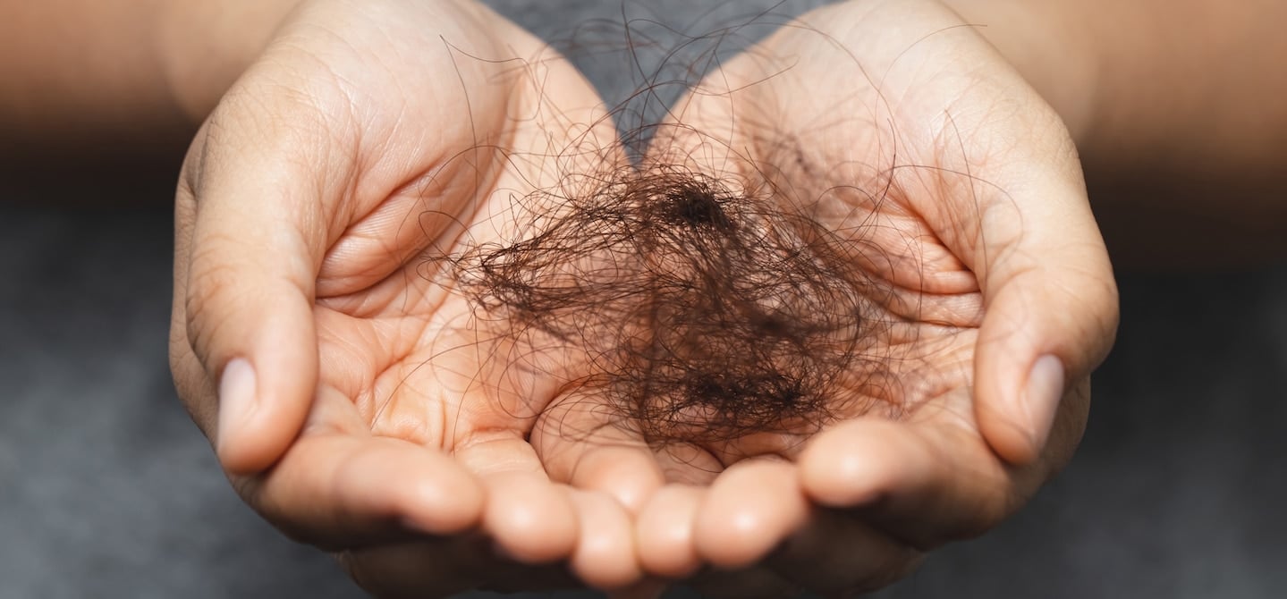 11 Potential Causes of Hair Loss and Baldness