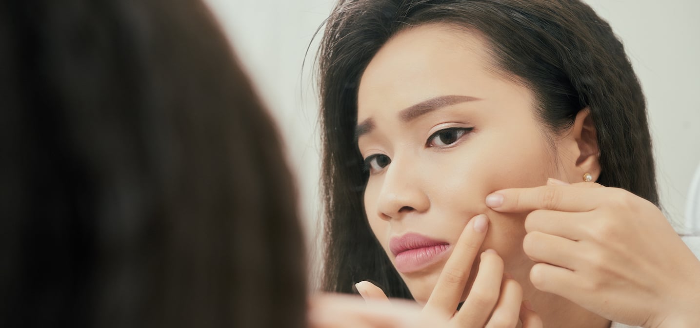 What to Do After Popping a Pimple, According to Experts