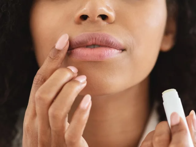 how to get rid of chapped lips chapstick