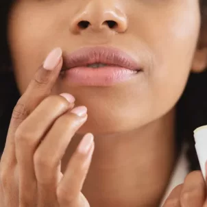 how to get rid of chapped lips chapstick