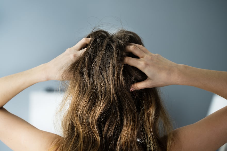 how to get rid of greasy hair