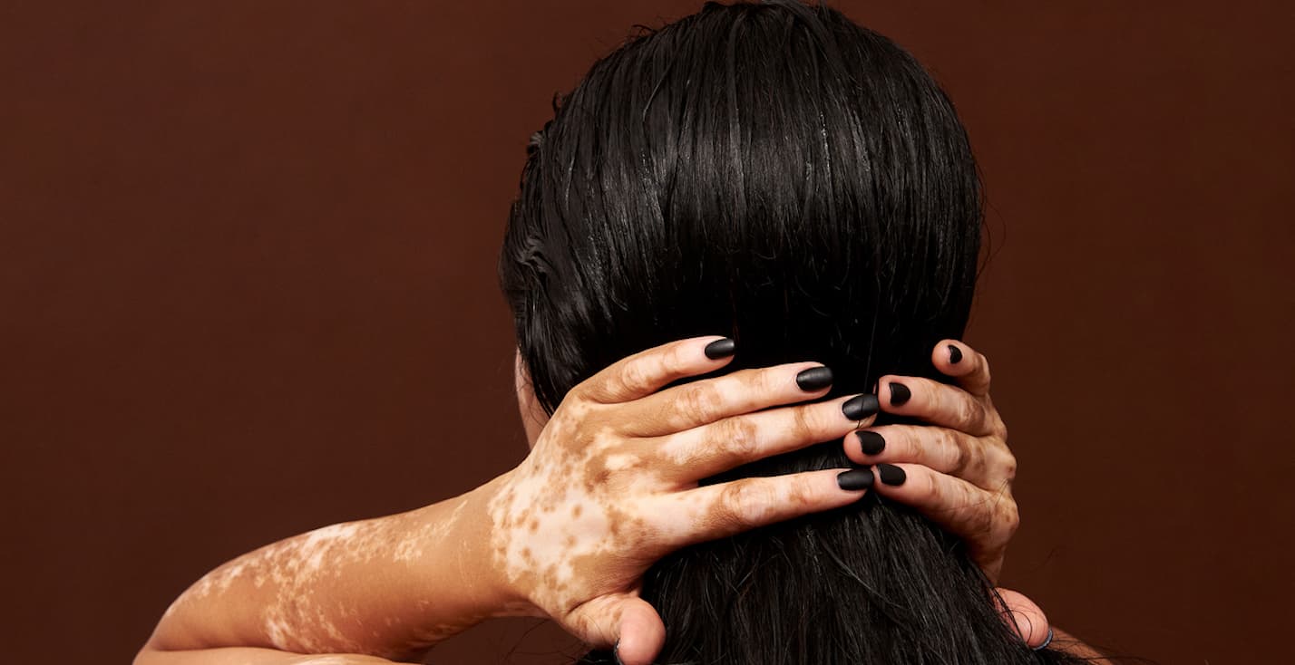 Why Is My Hair So Oily? A Trichologist Answers. | HUM Nutrition Blog Why Is My Hair So Oily? A Trichologist Answers. | HUM Nutrition Blog