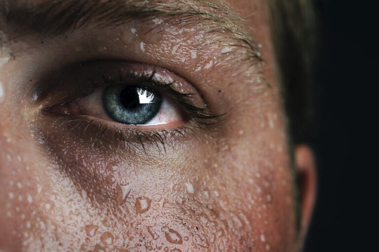 i sweat easily