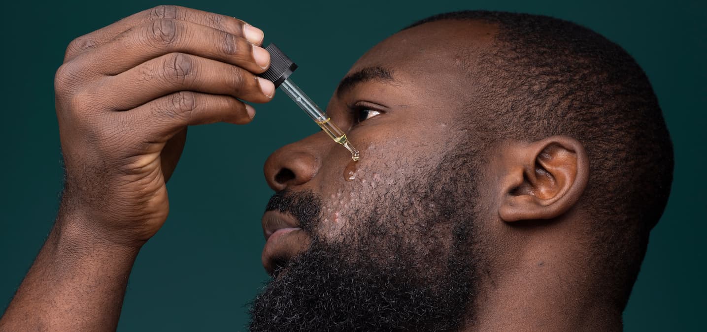 What Causes Acne? 8 Surprising Habits Behind Breakouts | HUM Nutrition Blog What Causes Acne? 8 Surprising Habits Behind Breakouts | HUM Nutrition Blog