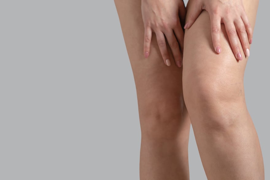 How to Prevent Chafing: 6 Steps to End Irritation