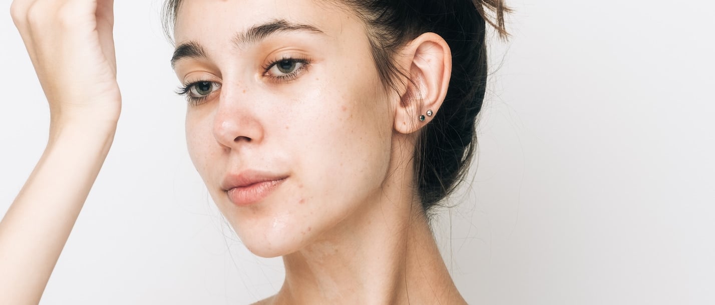 Vitamin B & Acne: Everything You Need to Know Vitamin B & Acne: Everything You Need to Know