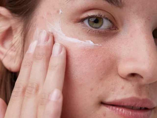 how to get rid of hormonal acne