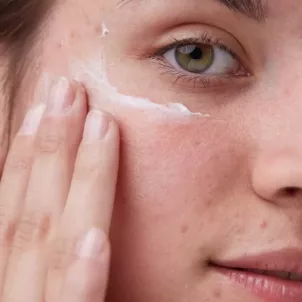 how to get rid of hormonal acne