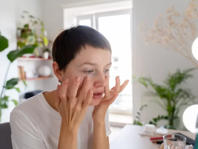 Woman looking at her retinol purge in the mirror