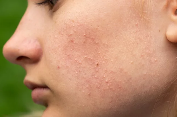 How Long Does Retinol Last