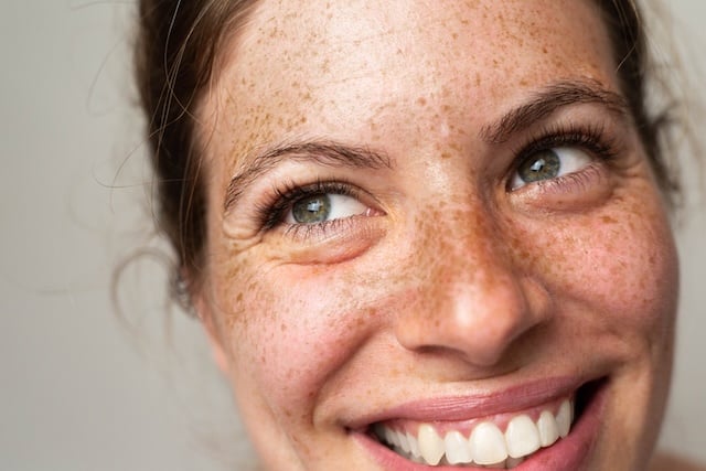 skin pores